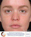 Obagi Nu-Derm Trial Kit - Normal to Dry