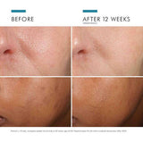 SkinCeuticals PHLORETIN