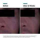 SkinCeuticals P-TIOX Anti-Wrinkle Cream