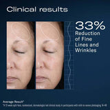 Skinbetter Science AlphaRet Overnight Cream