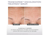 Glytone TranEXamide Discoloration Treatment Serum